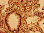 Immunohistochemistry of paraffin-embedded human lung tissue using CAC11165 at dilution of 1:100