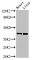 Western Blot; Positive WB detected in: Rat heart tissue, Mouse liver tissue; All lanes: MCAT antibody at 2.5µg/ml; Secondary; Goat polyclonal to rabbit IgG at 1/50000 dilution; Predicted band size: 43, 20 kDa; Observed band size: 43 kDa;