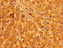 Immunohistochemistry of paraffin-embedded human liver tissue using CAC11166 at dilution of 1:100
