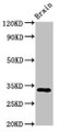Western Blot; Positive WB detected in: Mouse brain tissue; All lanes: ORAI1 antibody at 3.2µg/ml; Secondary; Goat polyclonal to rabbit IgG at 1/50000 dilution; Predicted band size: 33, 26 kDa; Observed band size: 33 kDa; Western Blot; Positive WB detected in: Mouse brain tissue; All lanes: ORAI1 antibody at 3.2µg/ml; Secondary; Goat polyclonal to rabbit IgG at 1/50000 dilution; Predicted band size: 33, 26 kDa; Observed band size: 33 kDa;