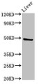 Western Blot; Positive WB detected in: Rat liver tissue; All lanes: PACSIN3 antibody at 2.7µg/ml; Secondary; Goat polyclonal to rabbit IgG at 1/50000 dilution; Predicted band size: 49 kDa; Observed band size: 49 kDa;