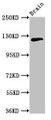 Western Blot; Positive WB detected in: Mouse brain tissue; All lanes: MYRF antibody at 3.2µg/ml; Secondary; Goat polyclonal to rabbit IgG at 1/50000 dilution; Predicted band size: 125, 121 kDa; Observed band size: 125 kDa;