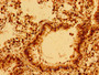 Immunohistochemistry of paraffin-embedded human lung tissue using CAC11173 at dilution of 1:100