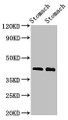 Western Blot; Positive WB detected in: Rat stomach tissue, Mouse stomach tissue; All lanes: POU3F1 antibody at 3µg/ml; Secondary; Goat polyclonal to rabbit IgG at 1/50000 dilution; Predicted band size: 46 kDa; Observed band size: 46 kDa;