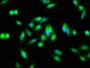 Immunofluorescence staining of Hela cells with CAC11180 at 1:133, counter-stained with DAPI. The cells were fixed in 4% formaldehyde, permeabilized using 0.2% Triton X-100 and blocked in 10% normal Goat Serum. The cells were then incubated with the antibody overnight at 4°C. The secondary antibody was Alexa Fluor 488-congugated AffiniPure Goat Anti-Rabbit IgG(H+L). Immunofluorescence staining of Hela cells with CAC11180 at 1:133, counter-stained with DAPI. The cells were fixed in 4% formaldehyde, permeabilized using 0.2% Triton X-100 and blocked in 10% normal Goat Serum. The cells were then incubated with the antibody overnight at 4°C. The secondary antibody was Alexa Fluor 488-congugated AffiniPure Goat Anti-Rabbit IgG(H+L).