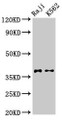 Western Blot; Positive WB detected in: Raji whole cell lysate, K562 whole cell lysate; All lanes: DMC1 antibody at 3.2µg/ml; Secondary; Goat polyclonal to rabbit IgG at 1/50000 dilution; Predicted band size: 38, 32 kDa; Observed band size: 38 kDa Western Blot; Positive WB detected in: Raji whole cell lysate, K562 whole cell lysate; All lanes: DMC1 antibody at 3.2µg/ml; Secondary; Goat polyclonal to rabbit IgG at 1/50000 dilution; Predicted band size: 38, 32 kDa; Observed band size: 38 kDa