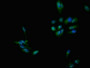 Immunofluorescent analysis of Hela cells using CAC11183 at dilution of 1:100 and Alexa Fluor 488-congugated AffiniPure Goat Anti-Rabbit IgG(H+L) Immunofluorescent analysis of Hela cells using CAC11183 at dilution of 1:100 and Alexa Fluor 488-congugated AffiniPure Goat Anti-Rabbit IgG(H+L)