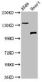 Western Blot; Positive WB detected in: A549 whole cell lysate, Rat heart tissue; All lanes: ADGRA2 antibody at 3µg/ml; Secondary; Goat polyclonal to rabbit IgG at 1/50000 dilution; Predicted band size: 143, 120, 20 kDa; Observed band size: 143, 120 kDa; Western Blot; Positive WB detected in: A549 whole cell lysate, Rat heart tissue; All lanes: ADGRA2 antibody at 3µg/ml; Secondary; Goat polyclonal to rabbit IgG at 1/50000 dilution; Predicted band size: 143, 120, 20 kDa; Observed band size: 143, 120 kDa;