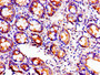 Immunohistochemistry of paraffin-embedded human small intestine tissue using CAC11187 at dilution of 1:100 Immunohistochemistry of paraffin-embedded human small intestine tissue using CAC11187 at dilution of 1:100