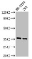 Western Blot; Positive WB detected in: SH-SY5Y whole cell lysate, 293 whole cell lysate; All lanes: GAS1 antibody at 3.2µg/ml; Secondary; Goat polyclonal to rabbit IgG at 1/50000 dilution; Predicted band size: 36 kDa; Observed band size: 36 kDa Western Blot; Positive WB detected in: SH-SY5Y whole cell lysate, 293 whole cell lysate; All lanes: GAS1 antibody at 3.2µg/ml; Secondary; Goat polyclonal to rabbit IgG at 1/50000 dilution; Predicted band size: 36 kDa; Observed band size: 36 kDa