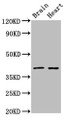 Western Blot; Positive WB detected in: Rat brain tissue, Rat heart tissue; All lanes: CERS1 antibody at 3µg/ml; Secondary; Goat polyclonal to rabbit IgG at 1/50000 dilution; Predicted band size: 40, 38 kDa; Observed band size: 40 kDa;