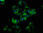Immunofluorescence staining of HepG2 cells with CAC11198 at 1:33, counter-stained with DAPI. The cells were fixed in 4% formaldehyde, permeabilized using 0.2% Triton X-100 and blocked in 10% normal Goat Serum. The cells were then incubated with the antibody overnight at 4°C. The secondary antibody was Alexa Fluor 488-congugated AffiniPure Goat Anti-Rabbit IgG(H+L). Immunofluorescence staining of HepG2 cells with CAC11198 at 1:33, counter-stained with DAPI. The cells were fixed in 4% formaldehyde, permeabilized using 0.2% Triton X-100 and blocked in 10% normal Goat Serum. The cells were then incubated with the antibody overnight at 4°C. The secondary antibody was Alexa Fluor 488-congugated AffiniPure Goat Anti-Rabbit IgG(H+L).