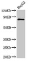 Western Blot; Positive WB detected in: HepG2 whole cell lysate; All lanes: NR3C1 antibody at 3µg/ml; Secondary; Goat polyclonal to rabbit IgG at 1/50000 dilution; Predicted band size: 86, 82, 65, 61, 83, 79, 77, 76, 52, 51, 50 kDa; Observed band size: 86 kDa Western Blot; Positive WB detected in: HepG2 whole cell lysate; All lanes: NR3C1 antibody at 3µg/ml; Secondary; Goat polyclonal to rabbit IgG at 1/50000 dilution; Predicted band size: 86, 82, 65, 61, 83, 79, 77, 76, 52, 51, 50 kDa; Observed band size: 86 kDa