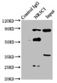 Immunoprecipitating NR3C1 in Hela whole cell lysate; , Lane 1: Rabbit control IgG instead in Hela whole cell lysate. For western blotting, a HRP-conjugated Protein G antibody was used as the secondary antibody (1/5000); , Lane 2: CAC11199 (8µg) + Hela whole cell lysate (500µg); , Lane 3: Hela whole cell lysate (20µg) Immunoprecipitating NR3C1 in Hela whole cell lysate; , Lane 1: Rabbit control IgG instead in Hela whole cell lysate. For western blotting, a HRP-conjugated Protein G antibody was used as the secondary antibody (1/5000); , Lane 2: CAC11199 (8µg) + Hela whole cell lysate (500µg); , Lane 3: Hela whole cell lysate (20µg)