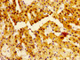 Immunohistochemistry of paraffin-embedded human adrenal gland tissue using CAC11200 at dilution of 1:100 Immunohistochemistry of paraffin-embedded human adrenal gland tissue using CAC11200 at dilution of 1:100