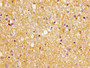Immunohistochemistry of paraffin-embedded human brain tissue using CAC11203 at dilution of 1:100 Immunohistochemistry of paraffin-embedded human brain tissue using CAC11203 at dilution of 1:100