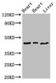 Western Blot; Positive WB detected in: Rat heart tissue, Mouse heart tissue, Mouse liver tissue; All lanes: ECI2 antibody at 2.7µg/ml; Secondary; Goat polyclonal to rabbit IgG at 1/50000 dilution; Predicted band size: 44, 40 kDa; Observed band size: 44 kDa; Western Blot; Positive WB detected in: Rat heart tissue, Mouse heart tissue, Mouse liver tissue; All lanes: ECI2 antibody at 2.7µg/ml; Secondary; Goat polyclonal to rabbit IgG at 1/50000 dilution; Predicted band size: 44, 40 kDa; Observed band size: 44 kDa;