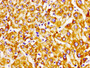 Immunohistochemistry of paraffin-embedded human liver tissue using CAC11209 at dilution of 1:100 Immunohistochemistry of paraffin-embedded human liver tissue using CAC11209 at dilution of 1:100