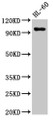 Western Blot; Positive WB detected in: HL60 whole cell lysate; All lanes: KMT5B antibody at 3µg/ml; Secondary; Goat polyclonal to rabbit IgG at 1/50000 dilution; Predicted band size: 100, 45, 32 kDa; Observed band size: 100 kDa Western Blot; Positive WB detected in: HL60 whole cell lysate; All lanes: KMT5B antibody at 3µg/ml; Secondary; Goat polyclonal to rabbit IgG at 1/50000 dilution; Predicted band size: 100, 45, 32 kDa; Observed band size: 100 kDa