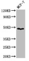 Western Blot; Positive WB detected in: MCF-7 whole cell lysate; All lanes: PANX1 antibody at 3.2µg/ml; Secondary; Goat polyclonal to rabbit IgG at 1/50000 dilution; Predicted band size: 49, 48 kDa; Observed band size: 49 kDa Western Blot; Positive WB detected in: MCF-7 whole cell lysate; All lanes: PANX1 antibody at 3.2µg/ml; Secondary; Goat polyclonal to rabbit IgG at 1/50000 dilution; Predicted band size: 49, 48 kDa; Observed band size: 49 kDa