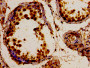 Immunohistochemistry of paraffin-embedded human testis tissue using CAC11219 at dilution of 1:100 Immunohistochemistry of paraffin-embedded human testis tissue using CAC11219 at dilution of 1:100