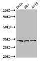 Western Blot; Positive WB detected in: Hela whole cell lysate, 293 whole cell lysate, A549 whole cell lysate; All lanes: GOLPH3 antibody at 3.2µg/ml; Secondary; Goat polyclonal to rabbit IgG at 1/50000 dilution; Predicted band size: 34 kDa; Observed band size: 34 kDa Western Blot; Positive WB detected in: Hela whole cell lysate, 293 whole cell lysate, A549 whole cell lysate; All lanes: GOLPH3 antibody at 3.2µg/ml; Secondary; Goat polyclonal to rabbit IgG at 1/50000 dilution; Predicted band size: 34 kDa; Observed band size: 34 kDa