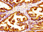 Immunohistochemistry of paraffin-embedded human prostate tissue using CAC11220 at dilution of 1:100 Immunohistochemistry of paraffin-embedded human prostate tissue using CAC11220 at dilution of 1:100