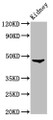Western Blot; Positive WB detected in: Rat kidney tissue; All lanes: FOXD3 antibody at 3.2µg/ml; Secondary; Goat polyclonal to rabbit IgG at 1/50000 dilution; Predicted band size: 48 kDa; Observed band size: 48 kDa; Western Blot; Positive WB detected in: Rat kidney tissue; All lanes: FOXD3 antibody at 3.2µg/ml; Secondary; Goat polyclonal to rabbit IgG at 1/50000 dilution; Predicted band size: 48 kDa; Observed band size: 48 kDa;