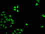Immunofluorescence staining of Hela cells with CAC11225 at 1:133, counter-stained with DAPI. The cells were fixed in 4% formaldehyde, permeabilized using 0.2% Triton X-100 and blocked in 10% normal Goat Serum. The cells were then incubated with the antibody overnight at 4°C. The secondary antibody was Alexa Fluor 488-congugated AffiniPure Goat Anti-Rabbit IgG(H+L). Immunofluorescence staining of Hela cells with CAC11225 at 1:133, counter-stained with DAPI. The cells were fixed in 4% formaldehyde, permeabilized using 0.2% Triton X-100 and blocked in 10% normal Goat Serum. The cells were then incubated with the antibody overnight at 4°C. The secondary antibody was Alexa Fluor 488-congugated AffiniPure Goat Anti-Rabbit IgG(H+L).