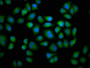 Immunofluorescence staining of Hela cells with CAC11229 at 1:133, counter-stained with DAPI. The cells were fixed in 4% formaldehyde, permeabilized using 0.2% Triton X-100 and blocked in 10% normal Goat Serum. The cells were then incubated with the antibody overnight at 4°C. The secondary antibody was Alexa Fluor 488-congugated AffiniPure Goat Anti-Rabbit IgG(H+L). Immunofluorescence staining of Hela cells with CAC11229 at 1:133, counter-stained with DAPI. The cells were fixed in 4% formaldehyde, permeabilized using 0.2% Triton X-100 and blocked in 10% normal Goat Serum. The cells were then incubated with the antibody overnight at 4°C. The secondary antibody was Alexa Fluor 488-congugated AffiniPure Goat Anti-Rabbit IgG(H+L).