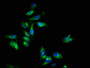 Immunofluorescence staining of Hela cells with CAC11230 at 1:133, counter-stained with DAPI. The cells were fixed in 4% formaldehyde, permeabilized using 0.2% Triton X-100 and blocked in 10% normal Goat Serum. The cells were then incubated with the antibody overnight at 4°C. The secondary antibody was Alexa Fluor 488-congugated AffiniPure Goat Anti-Rabbit IgG(H+L). Immunofluorescence staining of Hela cells with CAC11230 at 1:133, counter-stained with DAPI. The cells were fixed in 4% formaldehyde, permeabilized using 0.2% Triton X-100 and blocked in 10% normal Goat Serum. The cells were then incubated with the antibody overnight at 4°C. The secondary antibody was Alexa Fluor 488-congugated AffiniPure Goat Anti-Rabbit IgG(H+L).