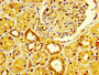 IHC image of CAC11233 diluted at 1:600 and staining in paraffin-embedded human kidney tissue performed on a Leica BondTM system. After dewaxing and hydration, antigen retrieval was mediated by high pressure in a citrate buffer (pH 6.0). Section was blocked with 10% normal goat serum 30min at RT. Then primary antibody (1% BSA) was incubated at 4°C overnight. The primary is detected by a biotinylated secondary antibody and visualized using an HRP conjugated SP system. IHC image of CAC11233 diluted at 1:600 and staining in paraffin-embedded human kidney tissue performed on a Leica BondTM system. After dewaxing and hydration, antigen retrieval was mediated by high pressure in a citrate buffer (pH 6.0). Section was blocked with 10% normal goat serum 30min at RT. Then primary antibody (1% BSA) was incubated at 4°C overnight. The primary is detected by a biotinylated secondary antibody and visualized using an HRP conjugated SP system.
