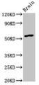 Western Blot; Positive WB detected in: Rat brain tissue; All lanes: GDF10 antibody at 4.5µg/ml; Secondary; Goat polyclonal to rabbit IgG at 1/50000 dilution; Predicted band size: 54 kDa; Observed band size: 54 kDa; Western Blot; Positive WB detected in: Rat brain tissue; All lanes: GDF10 antibody at 4.5µg/ml; Secondary; Goat polyclonal to rabbit IgG at 1/50000 dilution; Predicted band size: 54 kDa; Observed band size: 54 kDa;