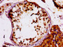 IHC image diluted at 1:100 and staining in paraffin-embedded human testis tissue performed on a Leica BondTM system. After dewaxing and hydration, antigen retrieval was mediated by high pressure in a citrate buffer (pH 6.0). Section was blocked with 10% normal goat serum 30min at RT. Then primary antibody (1% BSA) was incubated at 4°C overnight. The primary is detected by a biotinylated secondary antibody and visualized using an HRP conjugated SP system. IHC image diluted at 1:100 and staining in paraffin-embedded human testis tissue performed on a Leica BondTM system. After dewaxing and hydration, antigen retrieval was mediated by high pressure in a citrate buffer (pH 6.0). Section was blocked with 10% normal goat serum 30min at RT. Then primary antibody (1% BSA) was incubated at 4°C overnight. The primary is detected by a biotinylated secondary antibody and visualized using an HRP conjugated SP system.