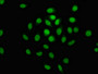 Immunofluorescence staining of A549 cells with CAC11238 at 1:100, counter-stained with DAPI. The cells were fixed in 4% formaldehyde, permeabilized using 0.2% Triton X-100 and blocked in 10% normal Goat Serum. The cells were then incubated with the antibody overnight at 4°C. The secondary antibody was Alexa Fluor 488-congugated AffiniPure Goat Anti-Rabbit IgG(H+L). Immunofluorescence staining of A549 cells with CAC11238 at 1:100, counter-stained with DAPI. The cells were fixed in 4% formaldehyde, permeabilized using 0.2% Triton X-100 and blocked in 10% normal Goat Serum. The cells were then incubated with the antibody overnight at 4°C. The secondary antibody was Alexa Fluor 488-congugated AffiniPure Goat Anti-Rabbit IgG(H+L).