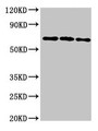 Western Blot; Positive WB detected in: 293T whole cell lysate, Hela whole cell lysate, HepG2 whole cell lysate; All lanes: NTN1 antibody at 6.4µg/ml; Secondary; Goat polyclonal to rabbit IgG at 1/50000 dilution; Predicted band size: 68 kDa; Observed band size: 68 kDa Western Blot; Positive WB detected in: 293T whole cell lysate, Hela whole cell lysate, HepG2 whole cell lysate; All lanes: NTN1 antibody at 6.4µg/ml; Secondary; Goat polyclonal to rabbit IgG at 1/50000 dilution; Predicted band size: 68 kDa; Observed band size: 68 kDa