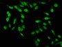 Immunofluorescence staining of Hela cells with CAC11241 at 1:100, counter-stained with DAPI. The cells were fixed in 4% formaldehyde, permeabilized using 0.2% Triton X-100 and blocked in 10% normal Goat Serum. The cells were then incubated with the antibody overnight at 4°C. The secondary antibody was Alexa Fluor 488-congugated AffiniPure Goat Anti-Rabbit IgG(H+L). Immunofluorescence staining of Hela cells with CAC11241 at 1:100, counter-stained with DAPI. The cells were fixed in 4% formaldehyde, permeabilized using 0.2% Triton X-100 and blocked in 10% normal Goat Serum. The cells were then incubated with the antibody overnight at 4°C. The secondary antibody was Alexa Fluor 488-congugated AffiniPure Goat Anti-Rabbit IgG(H+L).