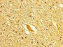 IHC image diluted at 1:300 and staining in paraffin-embedded human brain tissue performed on a Leica BondTM system. After dewaxing and hydration, antigen retrieval was mediated by high pressure in a citrate buffer (pH 6.0). Section was blocked with 10% normal goat serum 30min at RT. Then primary antibody (1% BSA) was incubated at 4°C overnight. The primary is detected by a biotinylated secondary antibody and visualized using an HRP conjugated SP system. IHC image diluted at 1:300 and staining in paraffin-embedded human brain tissue performed on a Leica BondTM system. After dewaxing and hydration, antigen retrieval was mediated by high pressure in a citrate buffer (pH 6.0). Section was blocked with 10% normal goat serum 30min at RT. Then primary antibody (1% BSA) was incubated at 4°C overnight. The primary is detected by a biotinylated secondary antibody and visualized using an HRP conjugated SP system.