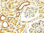 IHC image diluted at 1:300 and staining in paraffin-embedded human kidney tissue performed on a Leica BondTM system. After dewaxing and hydration, antigen retrieval was mediated by high pressure in a citrate buffer (pH 6.0). Section was blocked with 10% normal goat serum 30min at RT. Then primary antibody (1% BSA) was incubated at 4°C overnight. The primary is detected by a biotinylated secondary antibody and visualized using an HRP conjugated SP system. IHC image diluted at 1:300 and staining in paraffin-embedded human kidney tissue performed on a Leica BondTM system. After dewaxing and hydration, antigen retrieval was mediated by high pressure in a citrate buffer (pH 6.0). Section was blocked with 10% normal goat serum 30min at RT. Then primary antibody (1% BSA) was incubated at 4°C overnight. The primary is detected by a biotinylated secondary antibody and visualized using an HRP conjugated SP system.