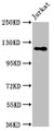 Western Blot; Positive WB detected in: Jurkat whole cell lysate; All lanes: SREBF1 antibody at 5.7µg/ml; Secondary; Goat polyclonal to rabbit IgG at 1/50000 dilution; Predicted band size: 122, 114, 112, 125, 49, 46 kDa; Observed band size: 122 kDa Western Blot; Positive WB detected in: Jurkat whole cell lysate; All lanes: SREBF1 antibody at 5.7µg/ml; Secondary; Goat polyclonal to rabbit IgG at 1/50000 dilution; Predicted band size: 122, 114, 112, 125, 49, 46 kDa; Observed band size: 122 kDa
