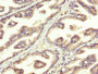 IHC image diluted at 1:300 and staining in paraffin-embedded human prostate tissue performed on a Leica BondTM system. After dewaxing and hydration, antigen retrieval was mediated by high pressure in a citrate buffer (pH 6.0). Section was blocked with 10% normal goat serum 30min at RT. Then primary antibody (1% BSA) was incubated at 4°C overnight. The primary is detected by a biotinylated secondary antibody and visualized using an HRP conjugated SP system. IHC image diluted at 1:300 and staining in paraffin-embedded human prostate tissue performed on a Leica BondTM system. After dewaxing and hydration, antigen retrieval was mediated by high pressure in a citrate buffer (pH 6.0). Section was blocked with 10% normal goat serum 30min at RT. Then primary antibody (1% BSA) was incubated at 4°C overnight. The primary is detected by a biotinylated secondary antibody and visualized using an HRP conjugated SP system.