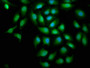 Immunofluorescence staining of A549 cells with CAC11245 at 1:100, counter-stained with DAPI. The cells were fixed in 4% formaldehyde, permeabilized using 0.2% Triton X-100 and blocked in 10% normal Goat Serum. The cells were then incubated with the antibody overnight at 4°C. The secondary antibody was Alexa Fluor 488-congugated AffiniPure Goat Anti-Rabbit IgG(H+L). Immunofluorescence staining of A549 cells with CAC11245 at 1:100, counter-stained with DAPI. The cells were fixed in 4% formaldehyde, permeabilized using 0.2% Triton X-100 and blocked in 10% normal Goat Serum. The cells were then incubated with the antibody overnight at 4°C. The secondary antibody was Alexa Fluor 488-congugated AffiniPure Goat Anti-Rabbit IgG(H+L).