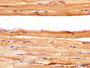IHC image of CAC11246 diluted at 1:400 and staining in paraffin-embedded human skeletal muscle tissue performed on a Leica BondTM system. After dewaxing and hydration, antigen retrieval was mediated by high pressure in a citrate buffer (pH 6.0). Section was blocked with 10% normal goat serum 30min at RT. Then primary antibody (1% BSA) was incubated at 4°C overnight. The primary is detected by a biotinylated secondary antibody and visualized using an HRP conjugated SP system. IHC image of CAC11246 diluted at 1:400 and staining in paraffin-embedded human skeletal muscle tissue performed on a Leica BondTM system. After dewaxing and hydration, antigen retrieval was mediated by high pressure in a citrate buffer (pH 6.0). Section was blocked with 10% normal goat serum 30min at RT. Then primary antibody (1% BSA) was incubated at 4°C overnight. The primary is detected by a biotinylated secondary antibody and visualized using an HRP conjugated SP system.