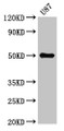 Western Blot; Positive WB detected in: U87 whole cell lysate; All lanes: URI1 antibody at 5.3µg/ml; Secondary; Goat polyclonal to rabbit IgG at 1/50000 dilution; Predicted band size: 60, 52, 57, 54 kDa; Observed band size: 52 kDa Western Blot; Positive WB detected in: U87 whole cell lysate; All lanes: URI1 antibody at 5.3µg/ml; Secondary; Goat polyclonal to rabbit IgG at 1/50000 dilution; Predicted band size: 60, 52, 57, 54 kDa; Observed band size: 52 kDa