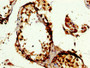 IHC image diluted at 1:300 and staining in paraffin-embedded human testis tissue performed on a Leica BondTM system. After dewaxing and hydration, antigen retrieval was mediated by high pressure in a citrate buffer (pH 6.0). Section was blocked with 10% normal goat serum 30min at RT. Then primary antibody (1% BSA) was incubated at 4°C overnight. The primary is detected by a biotinylated secondary antibody and visualized using an HRP conjugated SP system. IHC image diluted at 1:300 and staining in paraffin-embedded human testis tissue performed on a Leica BondTM system. After dewaxing and hydration, antigen retrieval was mediated by high pressure in a citrate buffer (pH 6.0). Section was blocked with 10% normal goat serum 30min at RT. Then primary antibody (1% BSA) was incubated at 4°C overnight. The primary is detected by a biotinylated secondary antibody and visualized using an HRP conjugated SP system.