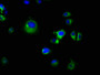 Immunofluorescence staining of MCF-7 cells with CAC11252 at 1:66, counter-stained with DAPI. The cells were fixed in 4% formaldehyde, permeabilized using 0.2% Triton X-100 and blocked in 10% normal Goat Serum. The cells were then incubated with the antibody overnight at 4°C. The secondary antibody was Alexa Fluor 488-congugated AffiniPure Goat Anti-Rabbit IgG(H+L). Immunofluorescence staining of MCF-7 cells with CAC11252 at 1:66, counter-stained with DAPI. The cells were fixed in 4% formaldehyde, permeabilized using 0.2% Triton X-100 and blocked in 10% normal Goat Serum. The cells were then incubated with the antibody overnight at 4°C. The secondary antibody was Alexa Fluor 488-congugated AffiniPure Goat Anti-Rabbit IgG(H+L).