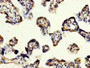 IHC image of CAC11254 diluted at 1:200 and staining in paraffin-embedded human placenta tissue performed on a Leica BondTM system. After dewaxing and hydration, antigen retrieval was mediated by high pressure in a citrate buffer (pH 6.0). Section was blocked with 10% normal goat serum 30min at RT. Then primary antibody (1% BSA) was incubated at 4°C overnight. The primary is detected by a biotinylated secondary antibody and visualized using an HRP conjugated SP system. IHC image of CAC11254 diluted at 1:200 and staining in paraffin-embedded human placenta tissue performed on a Leica BondTM system. After dewaxing and hydration, antigen retrieval was mediated by high pressure in a citrate buffer (pH 6.0). Section was blocked with 10% normal goat serum 30min at RT. Then primary antibody (1% BSA) was incubated at 4°C overnight. The primary is detected by a biotinylated secondary antibody and visualized using an HRP conjugated SP system.