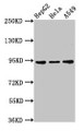 Western Blot; Positive WB detected in: HepG2 whole cell lysate, Hela whole cell lysate, A549 whole cell lysate; All lanes: CHD1L antibody at 3µg/ml; Secondary; Goat polyclonal to rabbit IgG at 1/50000 dilution; Predicted band size: 101, 91, 78, 89, 70 kDa; Observed band size: 91 kDa Western Blot; Positive WB detected in: HepG2 whole cell lysate, Hela whole cell lysate, A549 whole cell lysate; All lanes: CHD1L antibody at 3µg/ml; Secondary; Goat polyclonal to rabbit IgG at 1/50000 dilution; Predicted band size: 101, 91, 78, 89, 70 kDa; Observed band size: 91 kDa