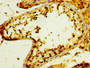 IHC image diluted at 1:300 and staining in paraffin-embedded human testis tissue performed on a Leica BondTM system. After dewaxing and hydration, antigen retrieval was mediated by high pressure in a citrate buffer (pH 6.0). Section was blocked with 10% normal goat serum 30min at RT. Then primary antibody (1% BSA) was incubated at 4°C overnight. The primary is detected by a biotinylated secondary antibody and visualized using an HRP conjugated SP system. IHC image diluted at 1:300 and staining in paraffin-embedded human testis tissue performed on a Leica BondTM system. After dewaxing and hydration, antigen retrieval was mediated by high pressure in a citrate buffer (pH 6.0). Section was blocked with 10% normal goat serum 30min at RT. Then primary antibody (1% BSA) was incubated at 4°C overnight. The primary is detected by a biotinylated secondary antibody and visualized using an HRP conjugated SP system.