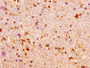 IHC image diluted at 1:100 and staining in paraffin-embedded human brain tissue performed on a Leica BondTM system. After dewaxing and hydration, antigen retrieval was mediated by high pressure in a citrate buffer (pH 6.0). Section was blocked with 10% normal goat serum 30min at RT. Then primary antibody (1% BSA) was incubated at 4°C overnight. The primary is detected by a biotinylated secondary antibody and visualized using an HRP conjugated SP system. IHC image diluted at 1:100 and staining in paraffin-embedded human brain tissue performed on a Leica BondTM system. After dewaxing and hydration, antigen retrieval was mediated by high pressure in a citrate buffer (pH 6.0). Section was blocked with 10% normal goat serum 30min at RT. Then primary antibody (1% BSA) was incubated at 4°C overnight. The primary is detected by a biotinylated secondary antibody and visualized using an HRP conjugated SP system.